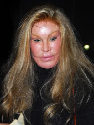 jocelyn-wildenstein.webp
